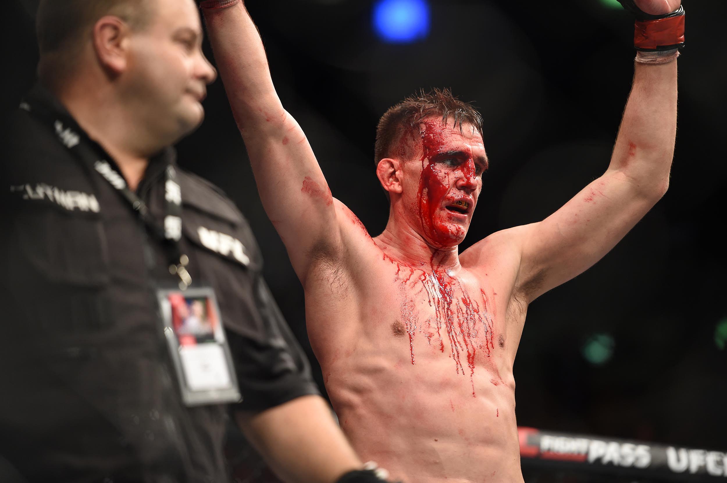 ufc deaths