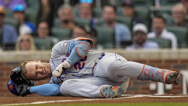Jun 7, 2023; Cumberland, Georgia, USA; New York Mets first baseman Pete Alonso (20) reacts after being hit by a pitch against the Atlanta Braves during the first inning at Truist Park. Mandatory Credit: Dale Zanine-USA TODAY Sports