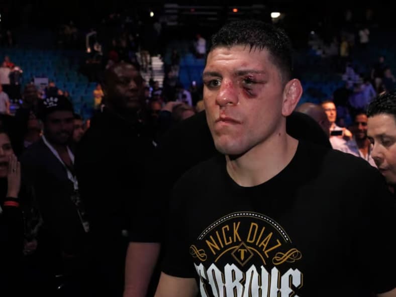Nick Diaz Getty Images